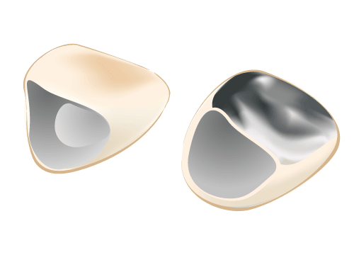 セレッククラウン